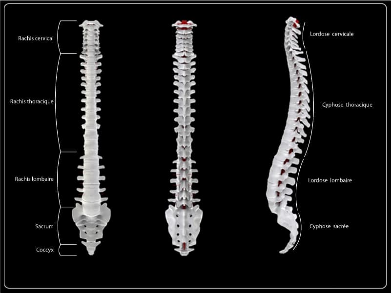 El cannabis y la espondiloartritis anquilosante