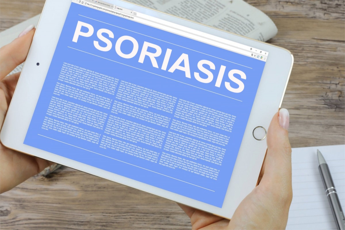 Cómo afecta el cannabis a la psoriasis